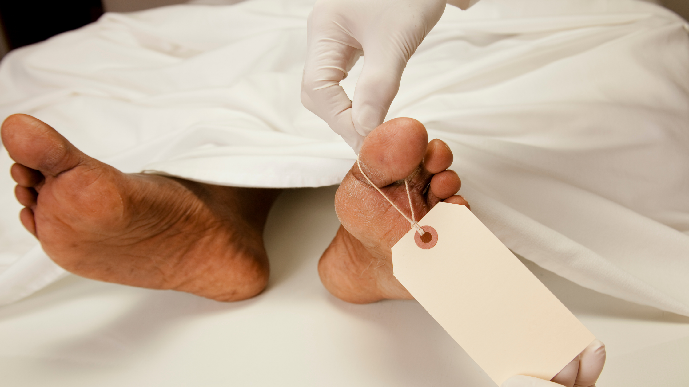 Five Facts You Need To Know About Embalming